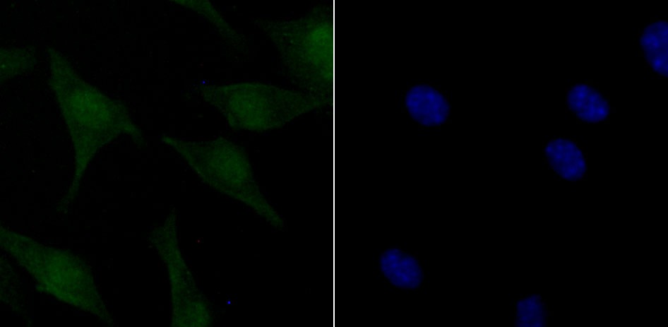 Anti-Phospho-ATM (Ser1981) Antibody (4B419)