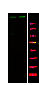 Anti-Phospho-ATM (Ser1893) Polyclonal Antibody