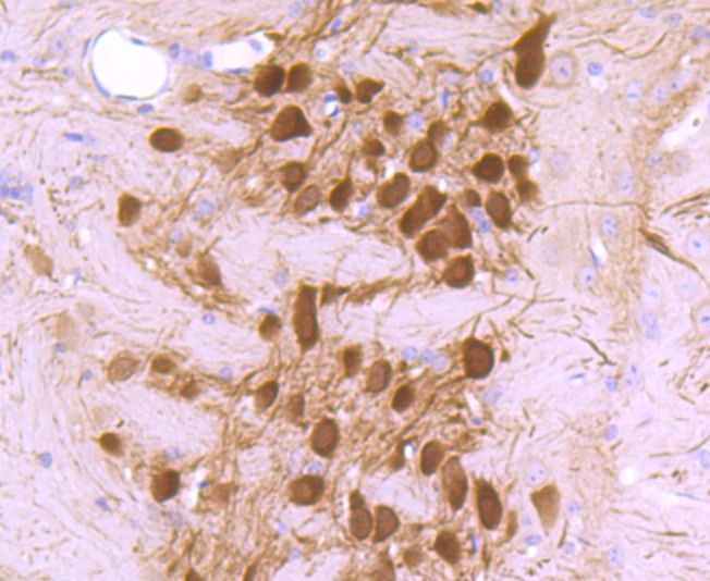 Anti-Calbindin Antibody (5F708)