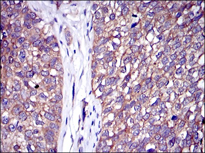 Anti-CBL Antibody (8B374)