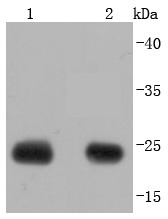 Anti-Calbindin Antibody (5F708)