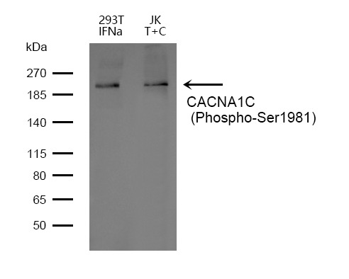 Anti-Phospho-CACNA1C (Ser1981) Polyclonal Antibody