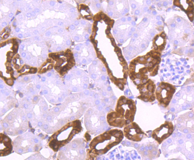 Anti-Calbindin Antibody (5F708)