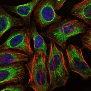 Anti-CBL Antibody (8B374)