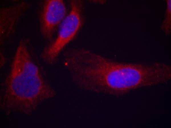 Anti-Phospho-CBL (Tyr700) Polyclonal Antibody