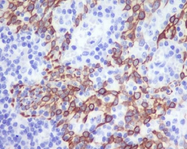 Anti-CCR2 Antibody (1X499)