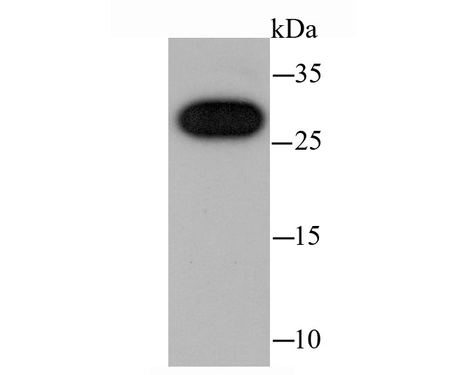 Anti-CBX7 Antibody (8C580)
