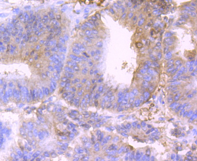 Anti-BST2 Antibody (3M264)