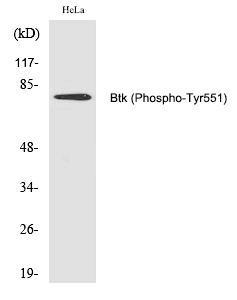 Anti-Phospho-BTK (Tyr551) Polyclonal Antibody