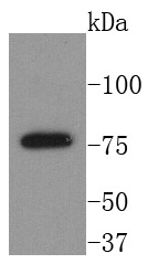 Anti-BTK Antibody (6Q257)