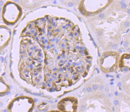 Anti-BST2 Antibody (3M264)