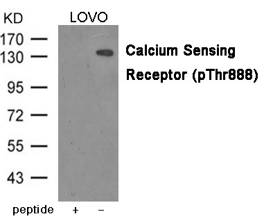 Anti-CASR Polyclonal Antibody
