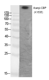 Anti-Acetyl-CREBBP (Lys1535) Polyclonal Antibody