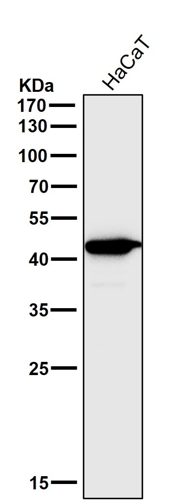 Anti-CCR2 Antibody (1X499)