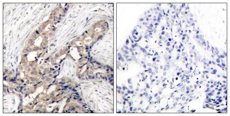 Anti-Phospho-C-ABL/ABL1 (Tyr412) Polyclonal Antibody