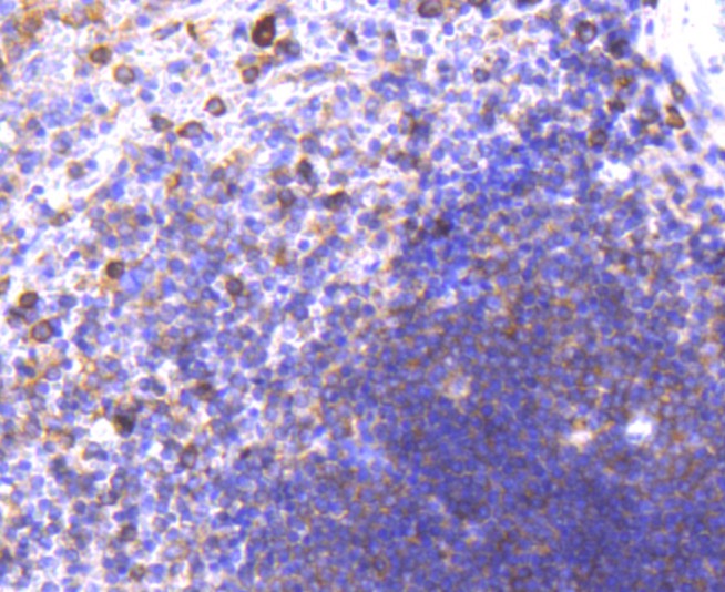 Anti-CD38 Antibody (4I413)