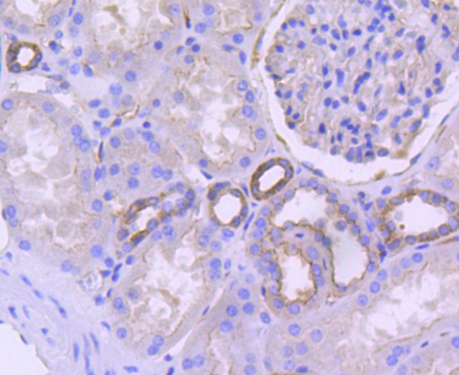 Anti-CD38 Antibody (4I413)