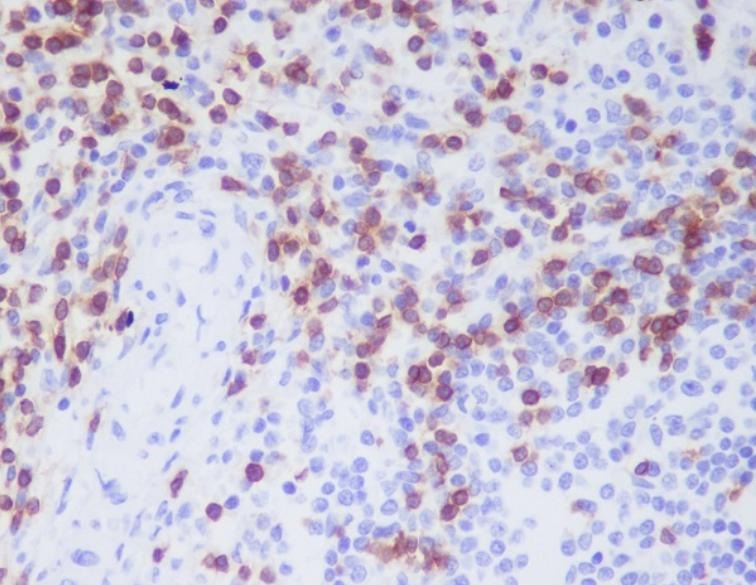 Anti-CD3D Antibody (1W363)