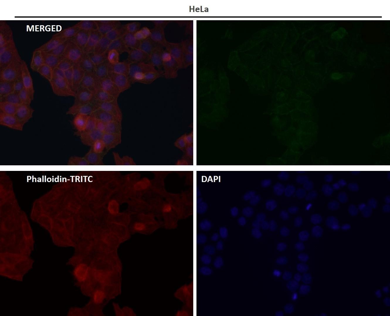 Anti-CD3D Antibody (1W363)