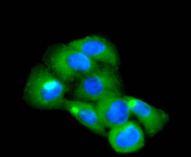 Anti-CD14 Antibody (7E908)