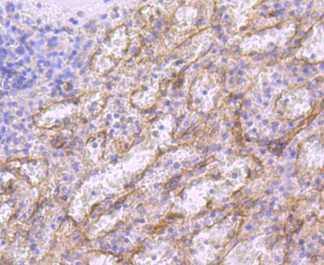 Anti-CD36 Antibody (6K672)