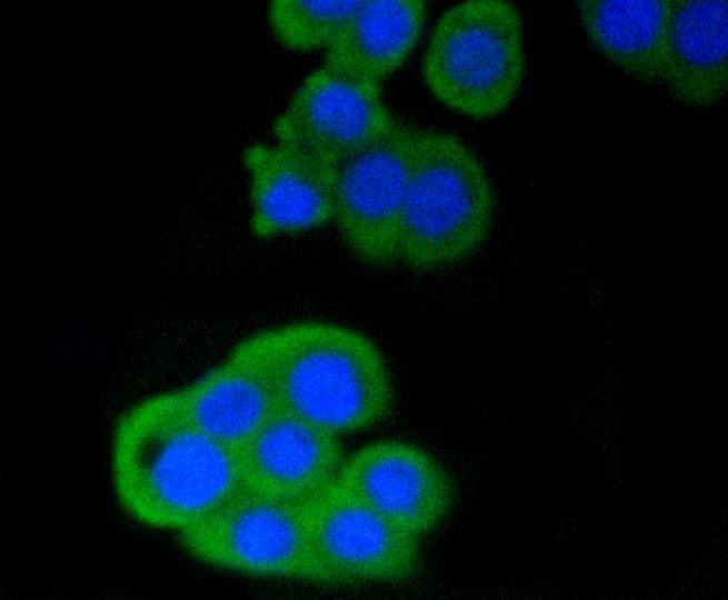 Anti-CD4 Antibody (2R601)