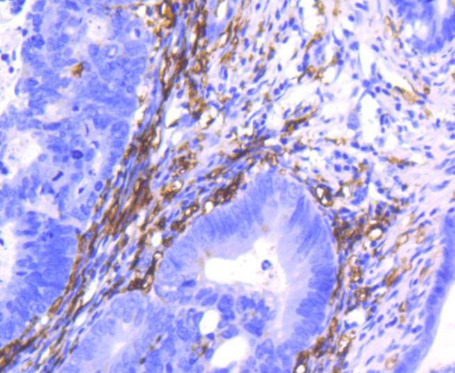 Anti-CD14 Antibody (7E908)