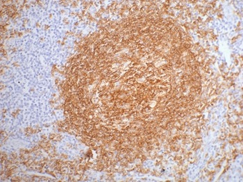Anti-KRT20 Antibody (8H18)