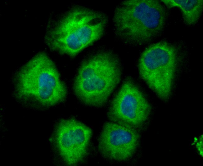 Anti-CD146/MCAM Antibody (6W862)