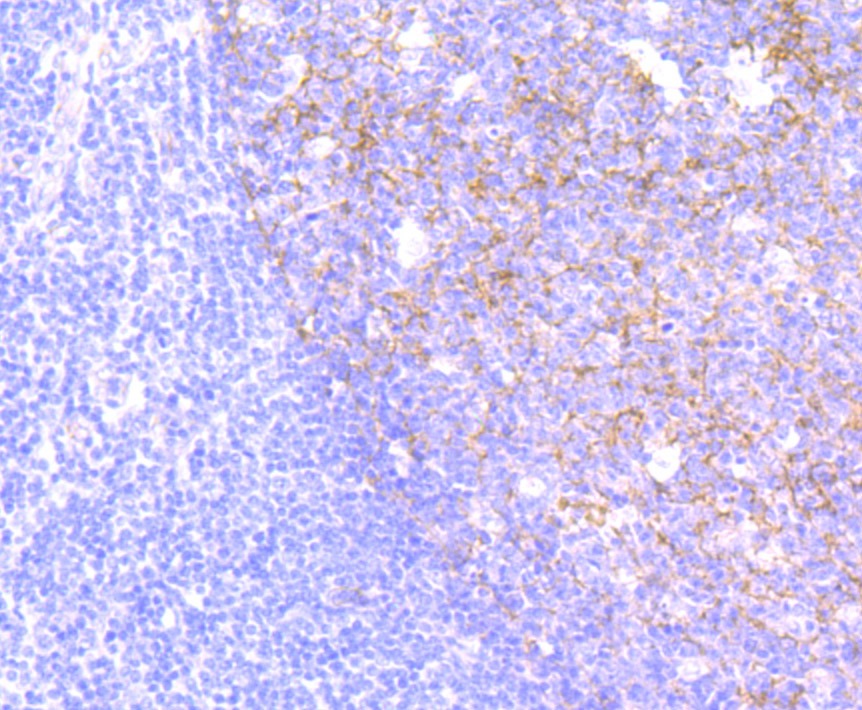 Anti-CD146/MCAM Antibody (6W862)