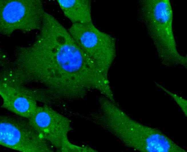Anti-CD14 Antibody (7E908)