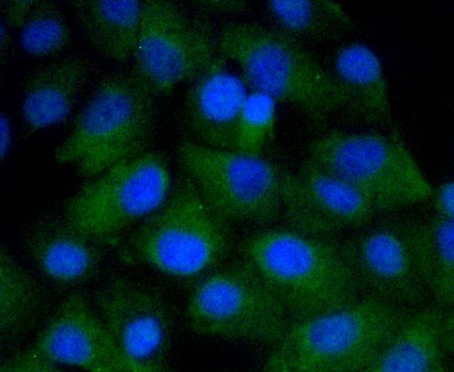Anti-CD4 Antibody (2R601)