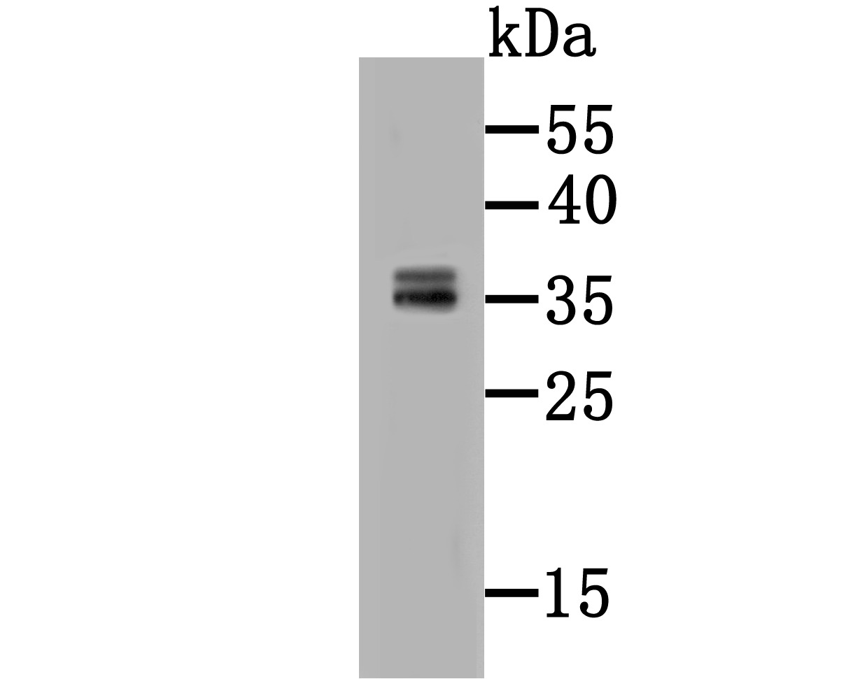 Anti-4-1BB/CD137/TNFRSF9 Antibody (9T808)