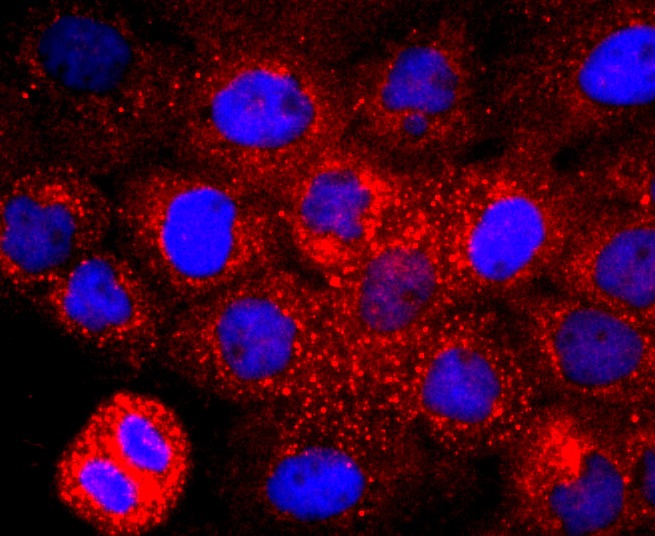 Anti-CD147 Antibody (7A20)