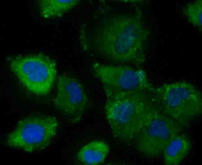 Anti-gp130/IL6ST Antibody (2B824)