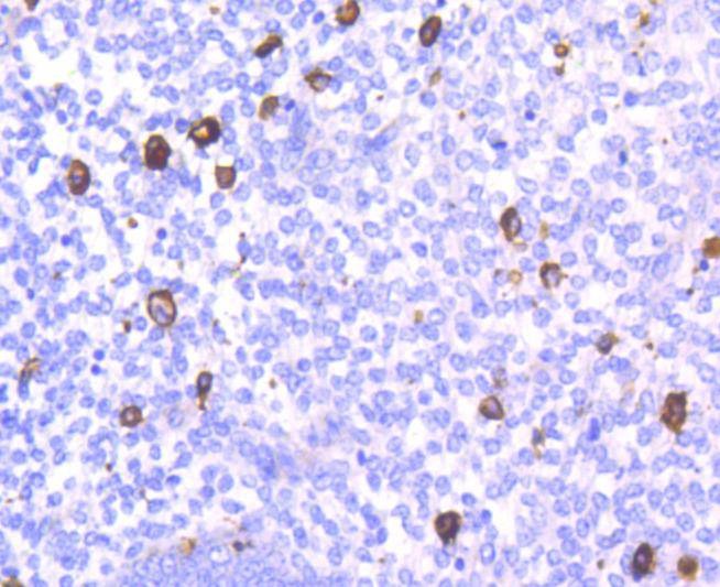 Anti-CD14 Antibody (7E908)