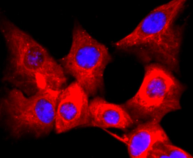 Anti-CD59 Antibody (2A586)