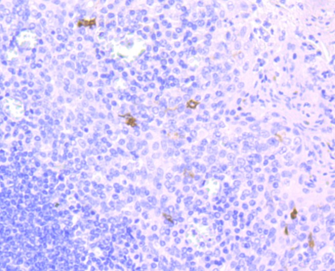 Anti-CD1A Antibody (9B433)