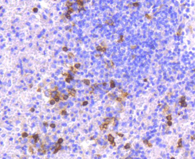 Anti-CD14 Antibody (7E908)