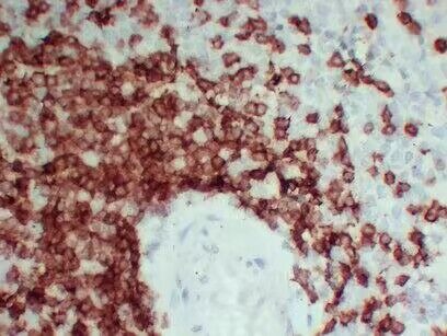 Anti-CD3 epsilon/CD3e Antibody (6D908)