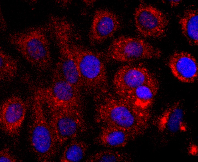 Anti-CD147 Antibody (7A20)