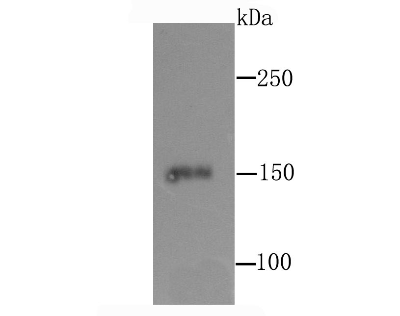 Anti-CD163 Antibody (3C775)