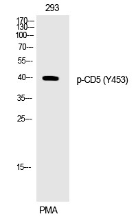 Anti-Phospho-CD5 (Tyr453) Polyclonal Antibody