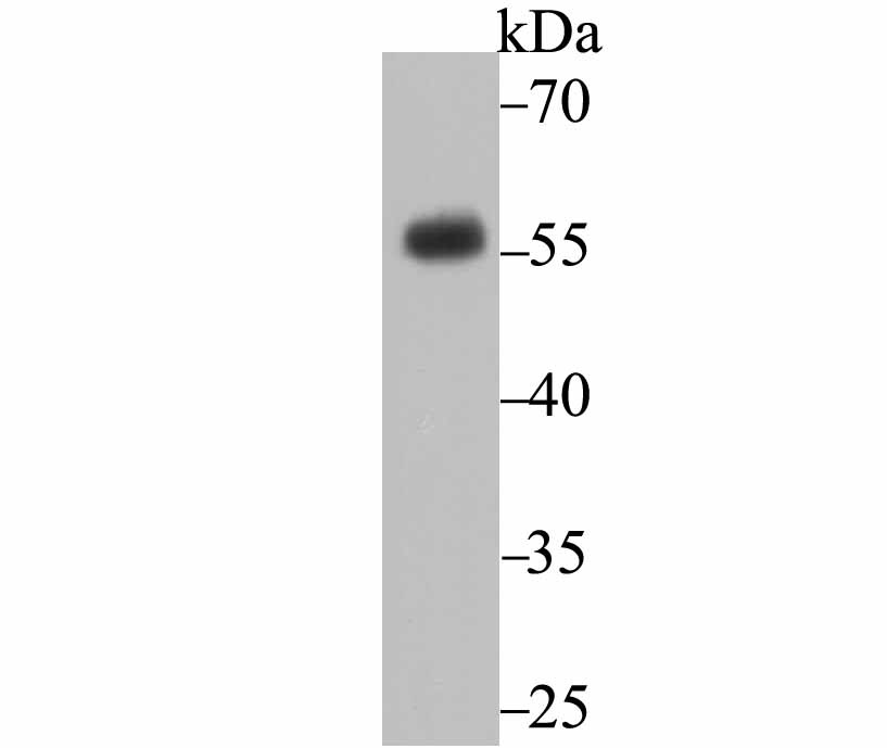 Anti-CD27/TNFRSF7 Antibody (8H198)