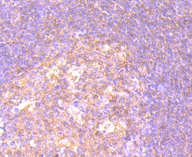 Anti-CD27/TNFRSF7 Antibody (8H198)