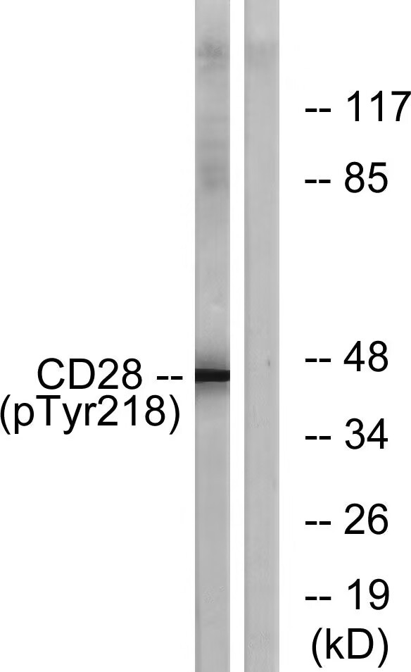 Anti-Phospho-CD28 (Tyr218) Polyclonal Antibody