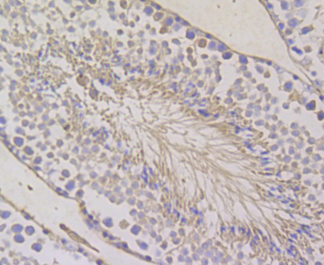 Anti-BCAP31 Antibody (4P206)