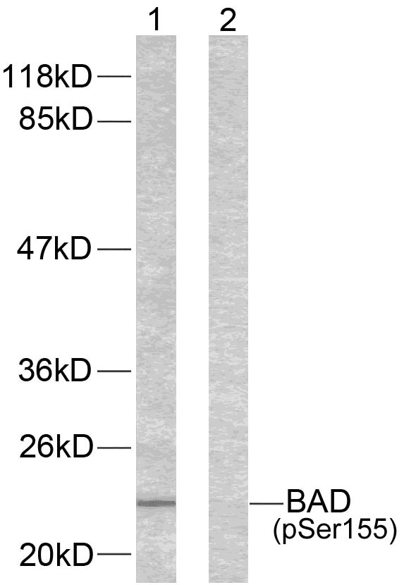 Anti-Phospho-Bad (Ser155) Polyclonal Antibody