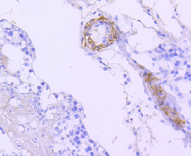Anti-BRAF Antibody (7W36)