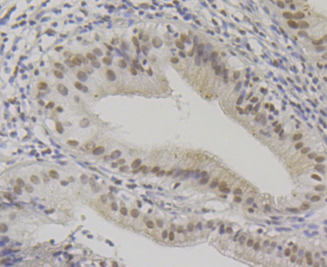 Anti-BAF57 Antibody (2O20)